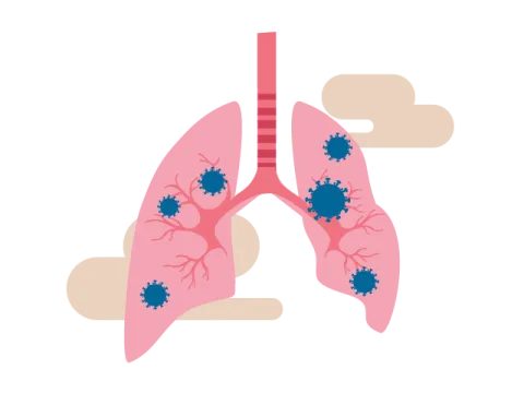 lung infections illustration